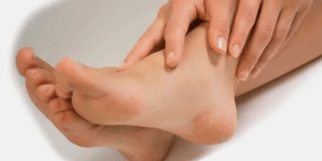 Treatment of nail mushrooms