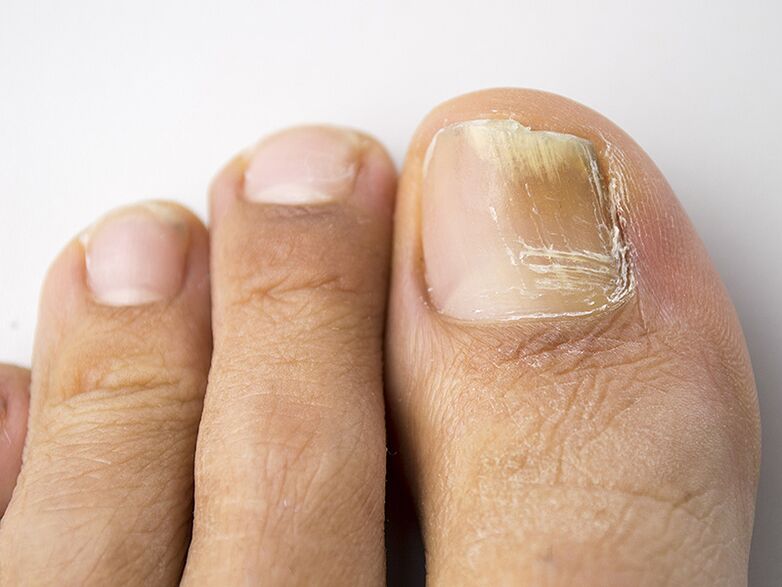 The initial phase of mushrooms